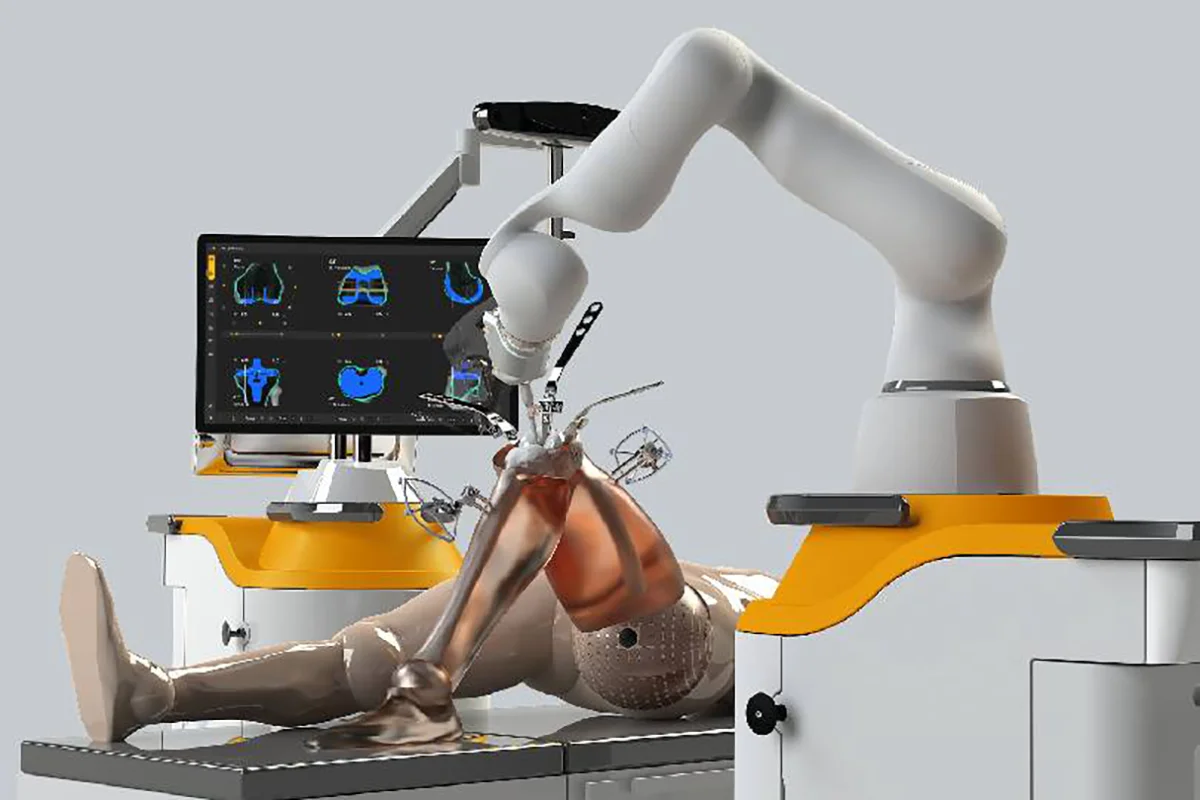 Best Fracture Treatment Clinic in Sector 51 Gurugram