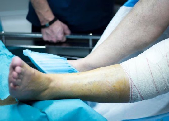 Best Fracture Treatment Servicein Sector 50, Gurugram